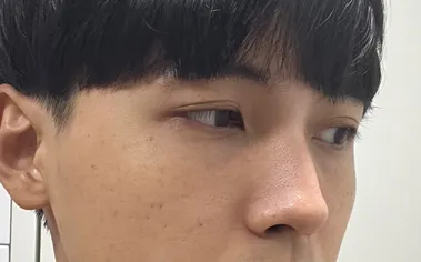 [鼻] 一個月 - 鼻、輪廓