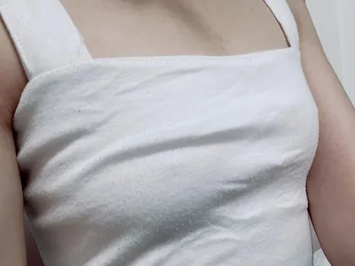 [隆胸] 胸部 - 隆胸