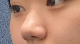 [鼻] 빚과부 - 鼻子、顴骨