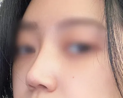 [鼻] 急煞車 - 鼻