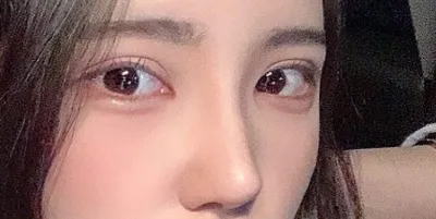 [眼部] 녑호 - 眼、鼻手術