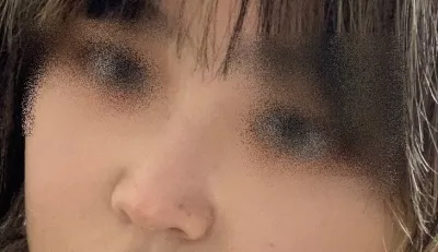 [鼻] 조라슬v - 鼻