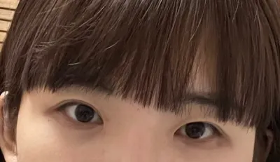 [眼睛] 蠢啊 - 眼睛