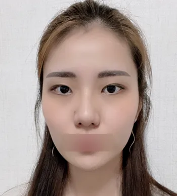 [顏面輪廓] 感謝 - 輪廓