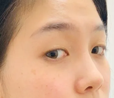 [眼部] 郭美女 - 眼、鼻