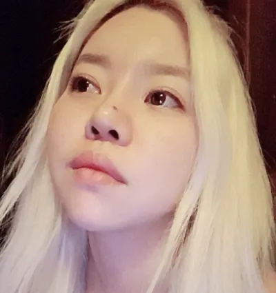 [眼睛] 뀩꺅 - 眼睛、鼻子、脂肪移植