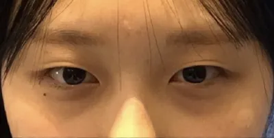 [眼部] Ollehri - 眼部