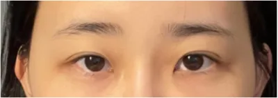 [眼睛] 油性筆 - 眼睛