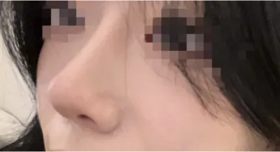 [鼻] 玻璃碎片 - 鼻