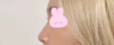 [鼻] 溫哥華 - 鼻