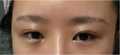 [眼睛] 黑手黨 - 眼睛