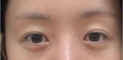 [眼睛] 三萬里 - 眼睛