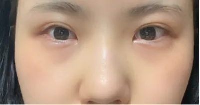 [眼睛] 噗뿡 – 眼睛、鼻子