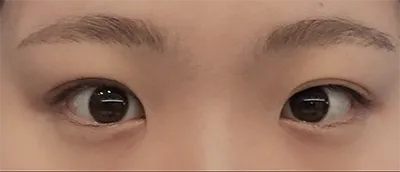 [眼睛] 밍루루루룩 - 眼睛