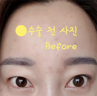 [眼部] 美國短毛貓眼型 - 眼部