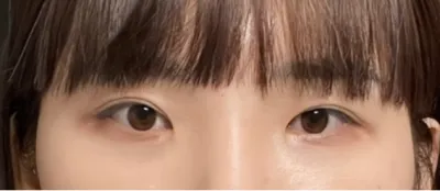 [眼睛] Daily Eye - 眼睛