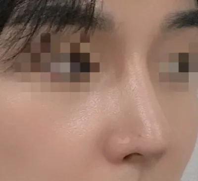 [鼻] 我是凱莉 - 鼻