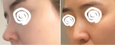 [鼻] Cucu Dazz - 鼻