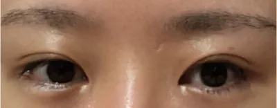 [眼睛] 鄭새우 - 眼睛