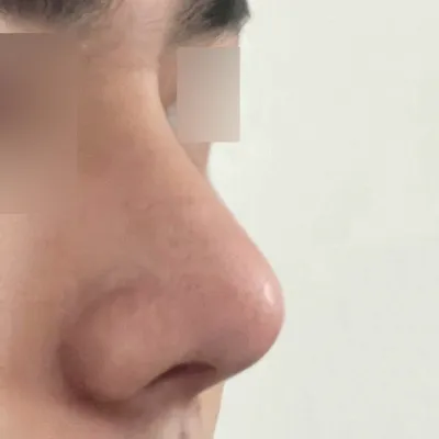 給沈正煥院長做手術已經1個月了。