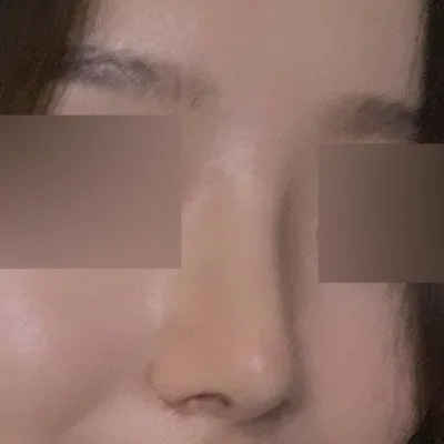 在Weverse做手術終於兩個月了