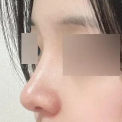 在Weverse做手術已經3個月了