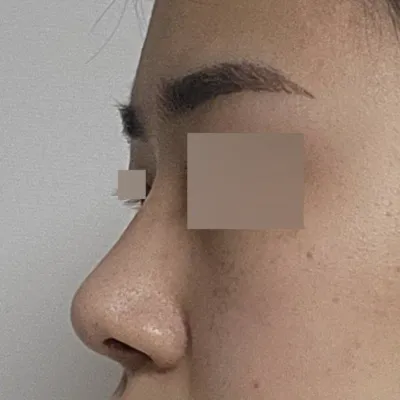 手術已經三個月了。