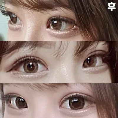 做眼睛手術已經三週啦 呵呵