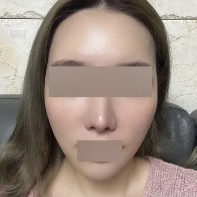 我在Weverse做了拉提手術，非常棒