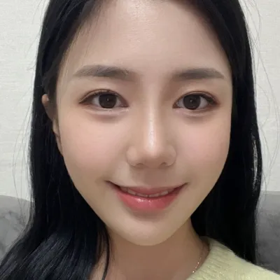 做完隆鼻和眼睛重修手術已經3個月了