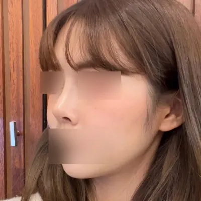 手術後，周圍的人都在稱讚我