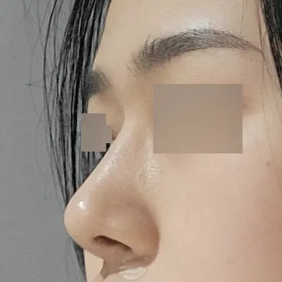 在Weverse做手術已經5個月了