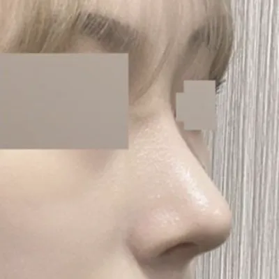 已經手術兩個月了！！