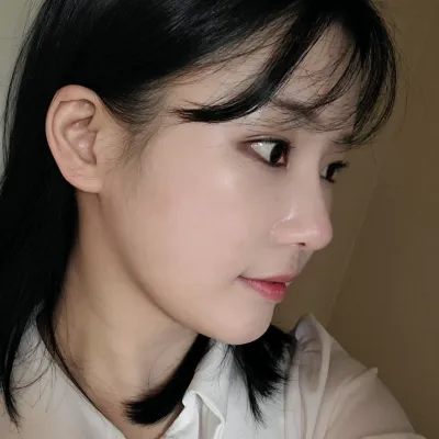 在維弗斯整形外科做眼鼻重修手術已經2個月了