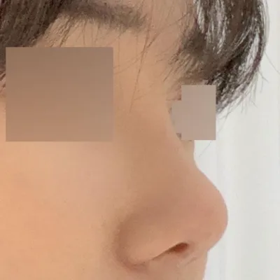 大家都問我在哪裡做得這麼自然又高挺~~~