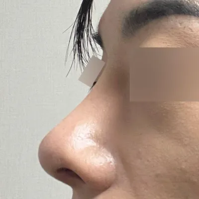 正在苦惱於重修手術的人一定要去看看沈院長