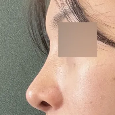 如果要我再做一次，我100%會選擇徐承祖院長！！