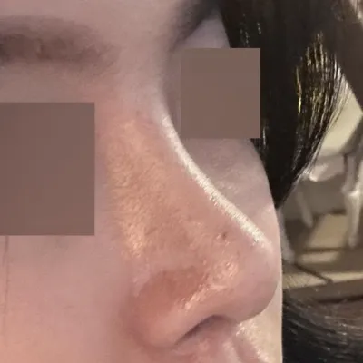 周圍的人都說我的鼻子很漂亮，我都聽習慣了，哈哈