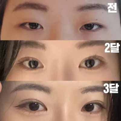 已經三個月了，看起來非常自然