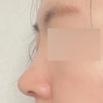 變得太漂亮了，素顏也變得自信了