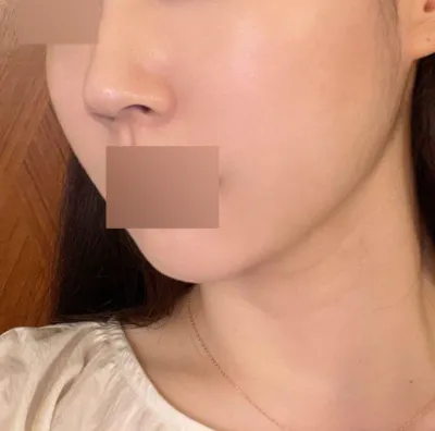 臉部線條整理得很好，看起來年輕了好幾歲，真好。