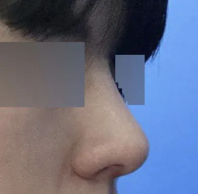 現在我明白為什麼人們說男人要隆直鼻了 哈哈哈