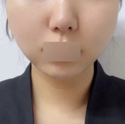 做線雕拉提真是神來之筆