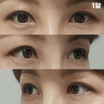 院長很敏銳，感覺也很好