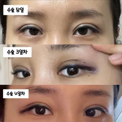 諮詢時不會過度，會好好看,,，最棒 最棒