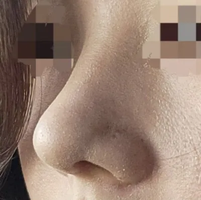 手術結果非常滿意！