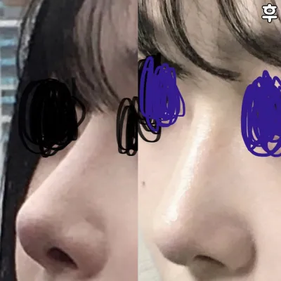 大家都說鼻子很漂亮