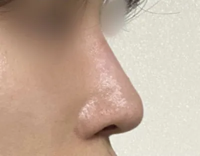 很高興擁有非常喜歡的鼻子！