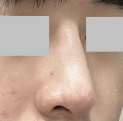 我想要自然的，結果非常符合我的要求