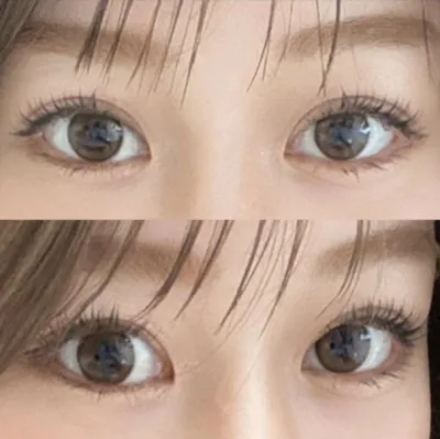 沒有過度診療，手術後也照顧得非常好ㅎㅎㅎ